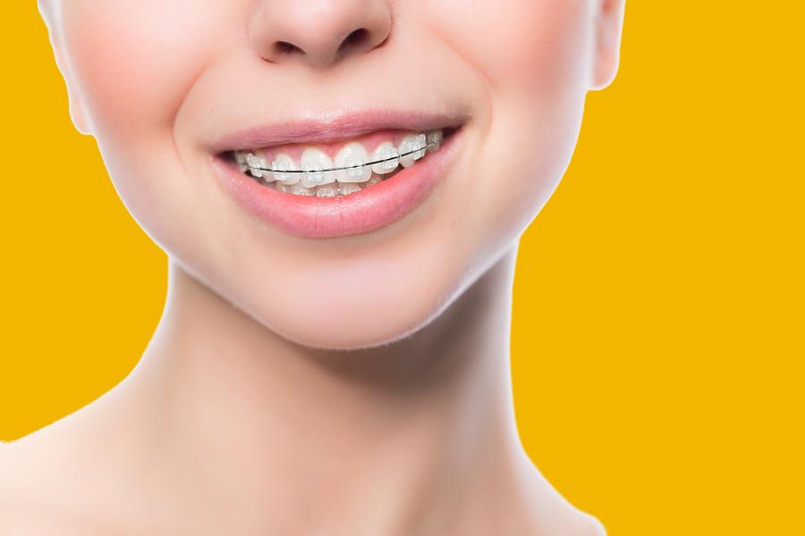  Top-5-Most-Common-Orthodontic-Problems