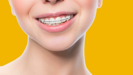 Top 5 Most Common Orthodontic Problems