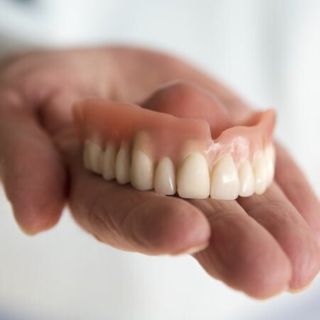 6 Major Reasons People Shouldn't Settle For Traditional Dentures