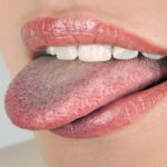 Bacteria living on your Tongue: How to Get Rid!