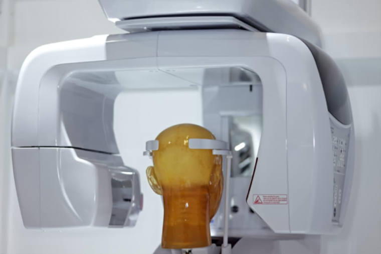 Cone Beam CT Scanner | Dental Scans Cork | Smile Store