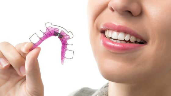 Mentor Invisalign