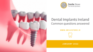 Dental Implants Ireland - Common Questions Answered