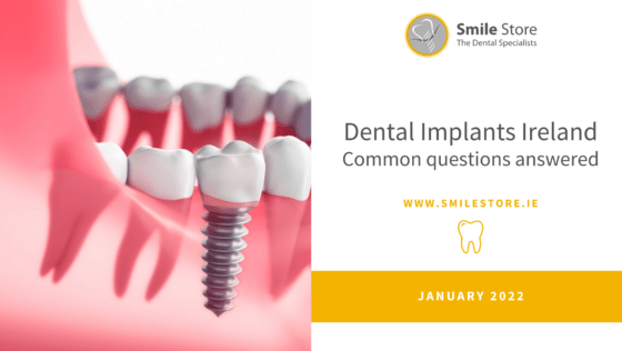 Dental Implants Ireland – Common Questions Answered