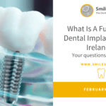 What Is A Full Mouth Dental Implant Cost In Ireland?