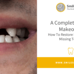 A Complete Smile Makeover – How To Restore Damaged Or Missing Teeth?