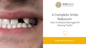 A Complete Smile Makeover How To Restore Damaged Or Missing Teeth?