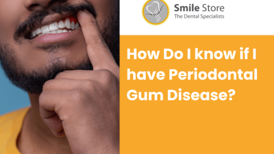 How Do I know if I have Periodontal Gum Disease?