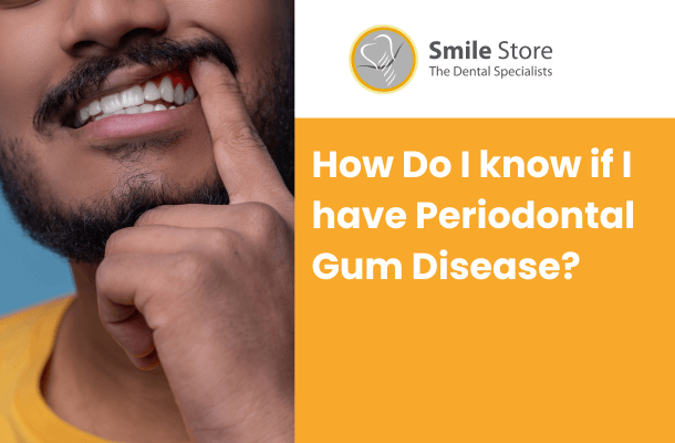 How Do I know if I have Periodontal Gum Disease? - Smile Store