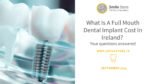 What Is A Full Mouth Dental Implant Cost In Ireland?